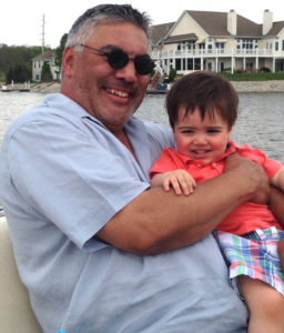 Mel Before Our Weight Loss Hypnotherapy